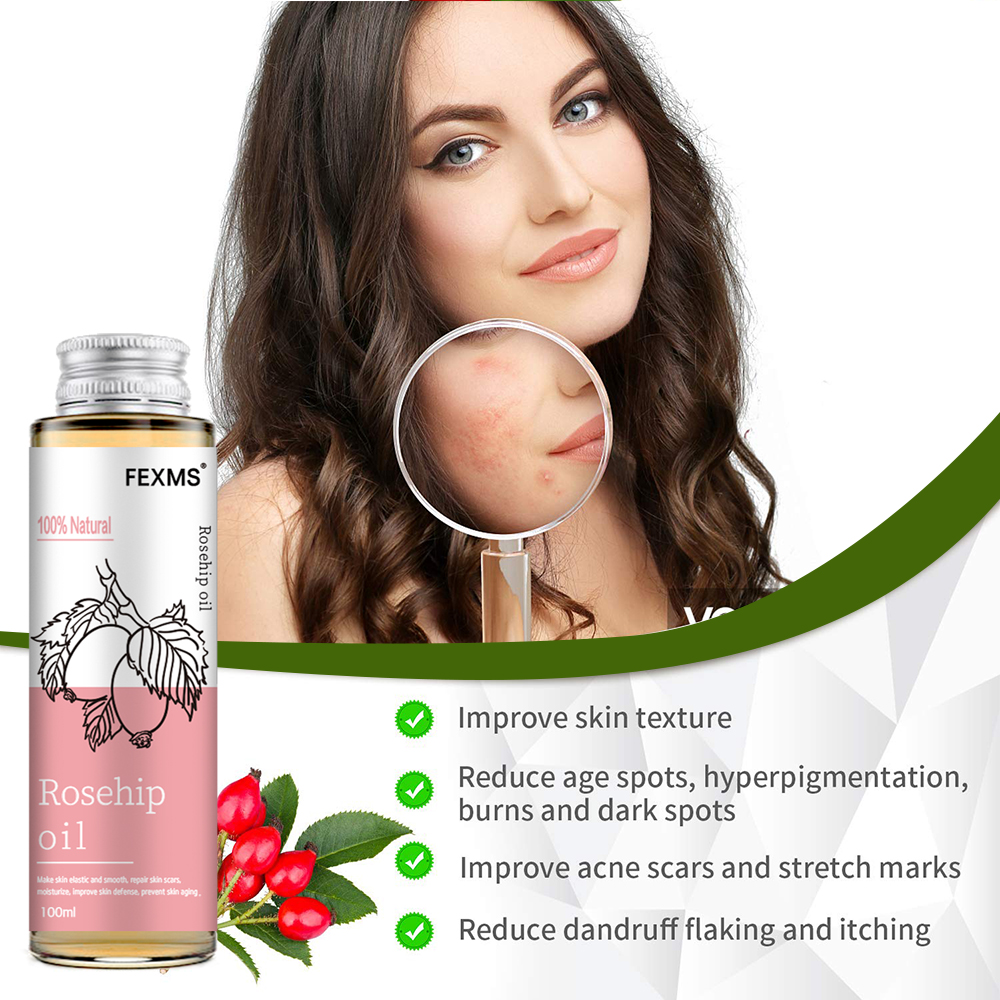 Rosehip Seed Oil, 100% Pure Or - đánh giá và giá Cold Pressed Rose Hip