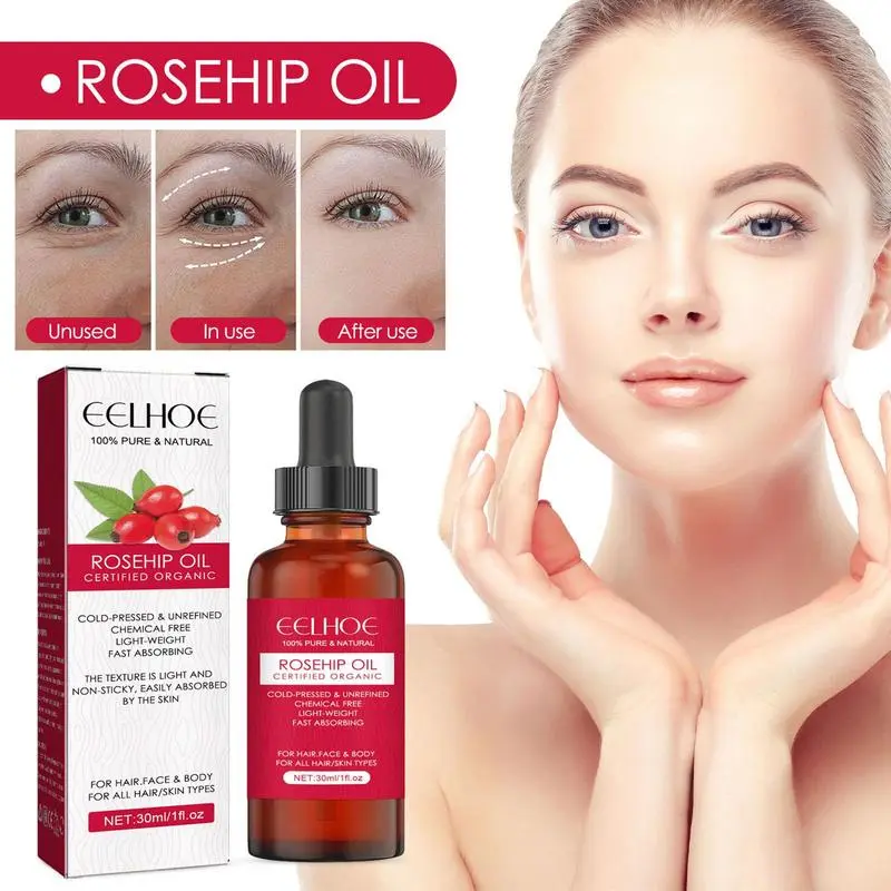 30ml Organic Rosehip Seed Oil  - đánh giá và giá Cold Pressed Rose Hip